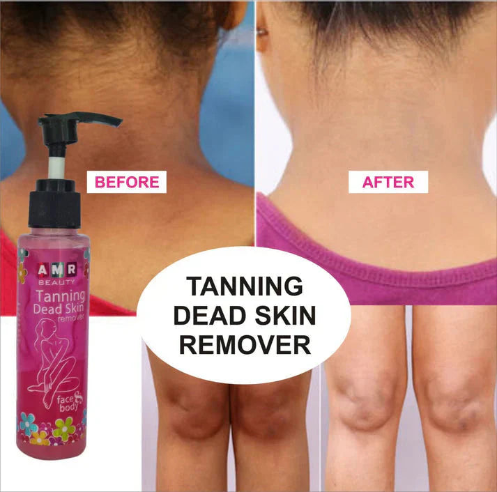 Tan Removal Gel -  Dead Skin & Tan Remover