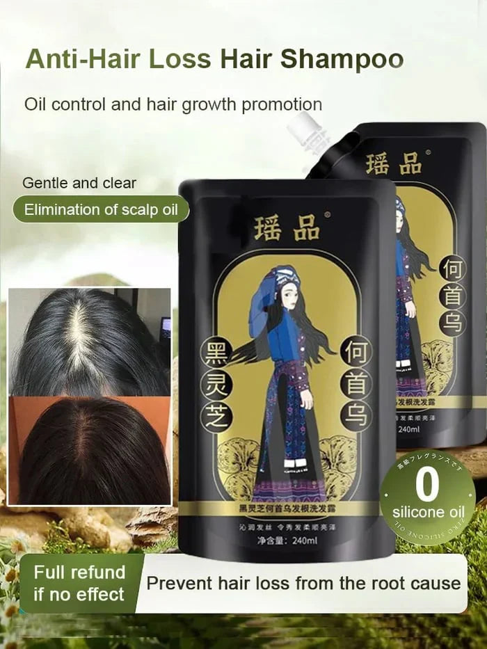 Ginger Extract Anti-Hair Loss Shampoo (Buy 1 Get 2🔥)