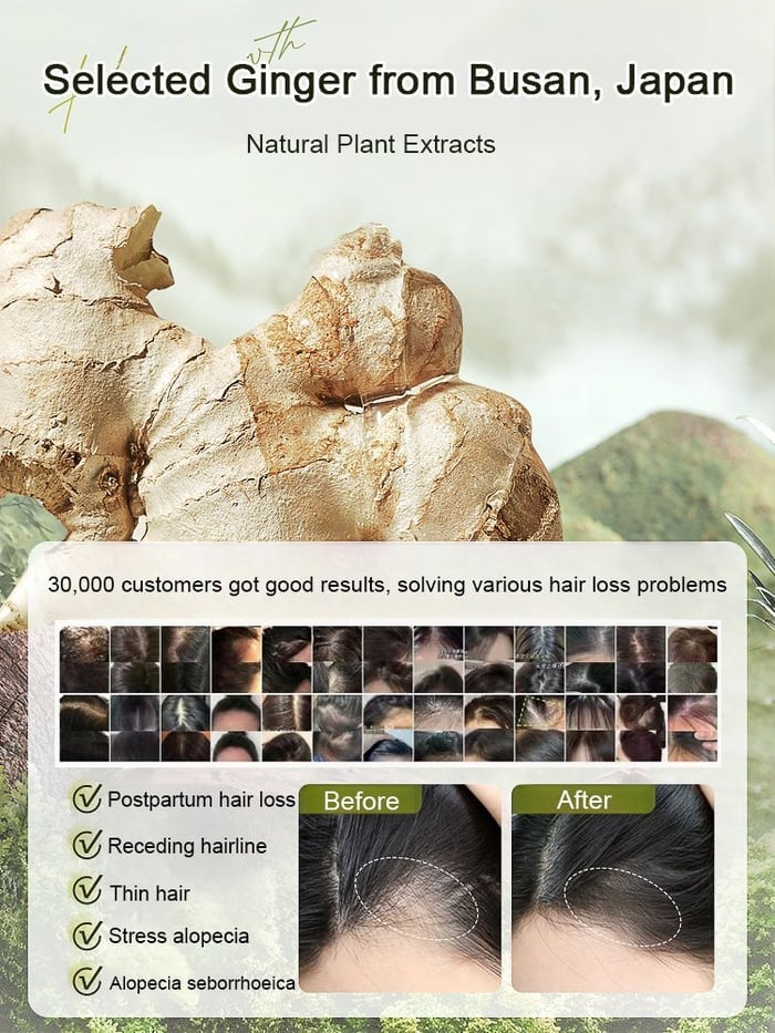 Ginger Plant Extract Anti-Hair Loss Shampoo - Hot Sale🔥